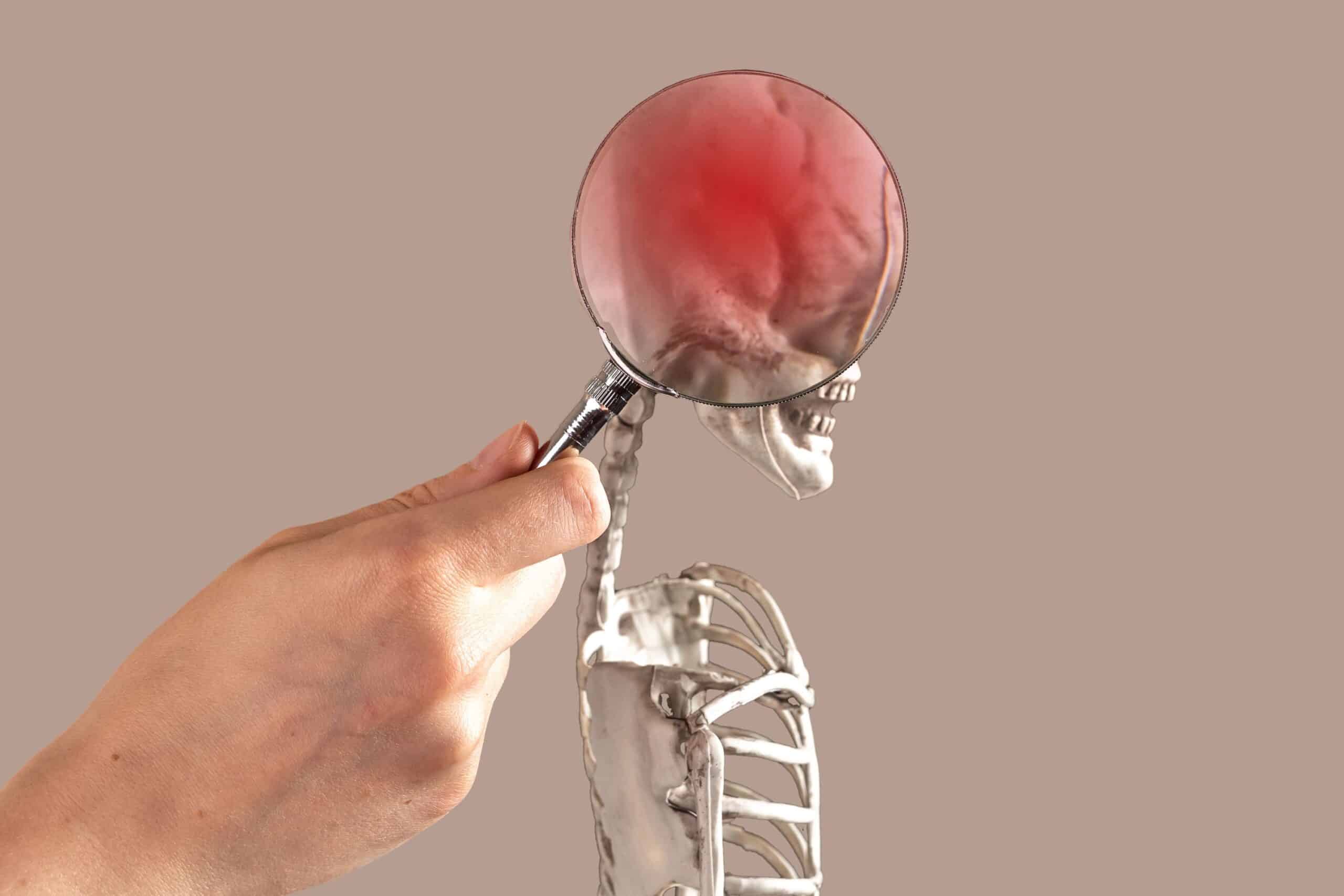 Brain Injuries in Minnesota: The Legal Rights of Victims and Pursuing Compensation