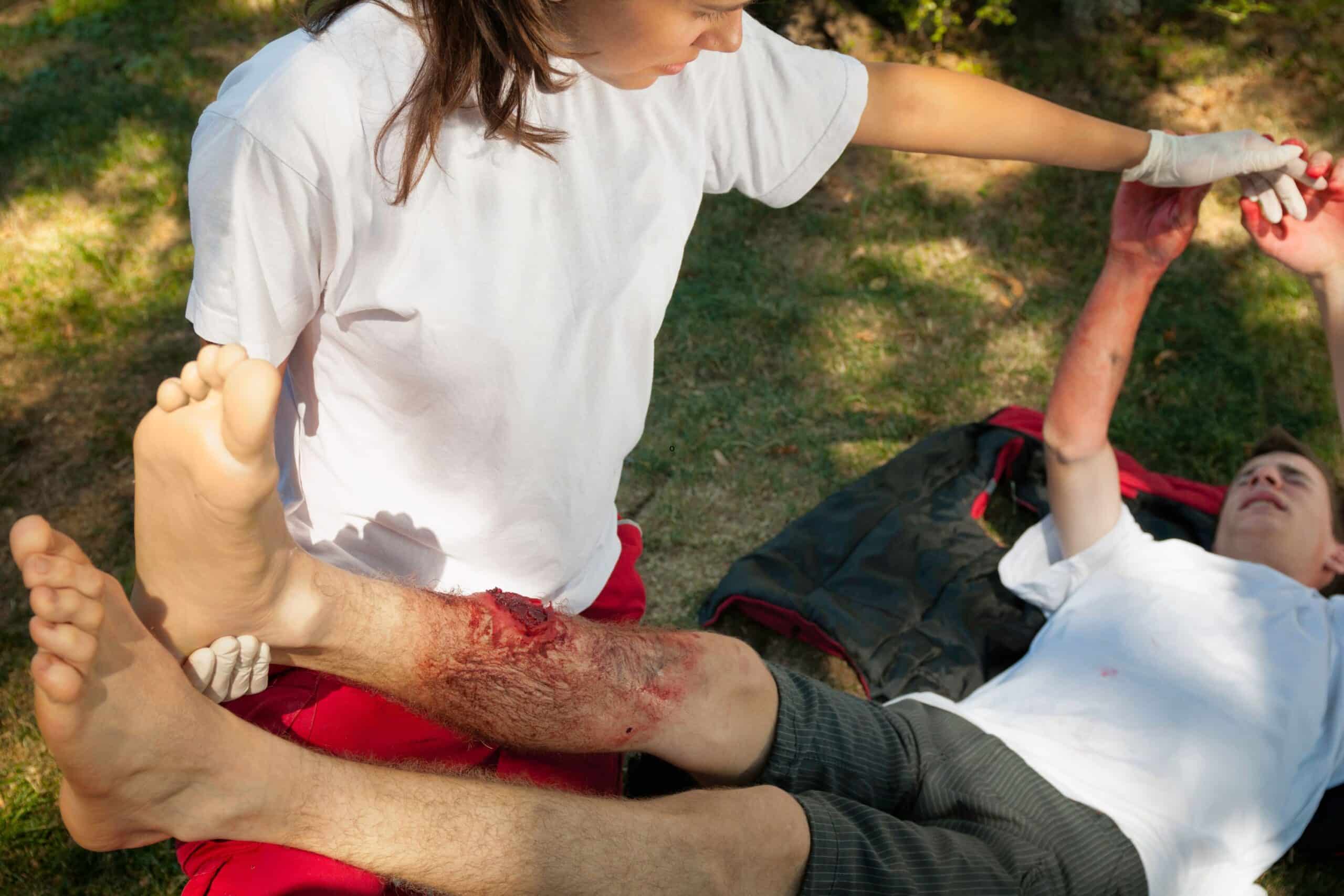 Burn Injury Victims in MN: Legal Options and Rehabilitation Support